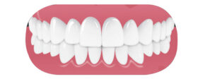 Zahnkorrektur: Gerade Zähne