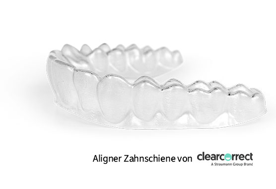Zahnkorrektur: Zahnschiene (Aligner) von ClearCorrect