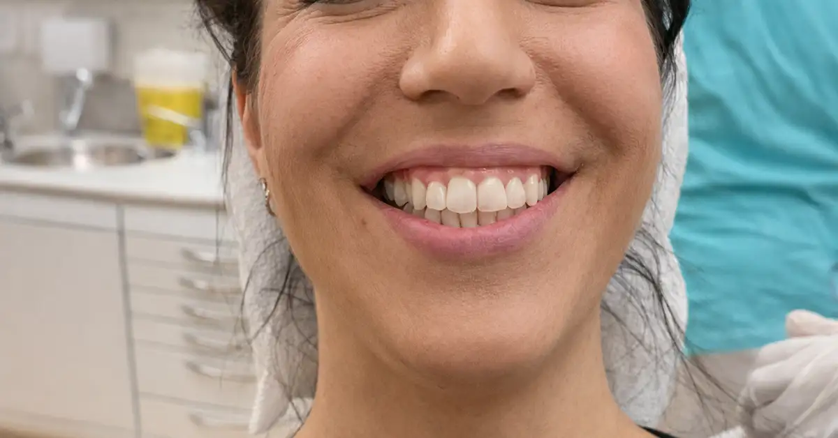 Zahnkorrektur mit ClearCorrect® bei Zahnengstand